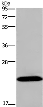 KCNMB4 Antibody in Western Blot (WB)
