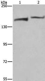 KDM5B Antibody in Western Blot (WB)