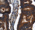 KLHL8 Antibody in Immunohistochemistry (Paraffin) (IHC (P))