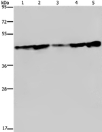 Lass4 Antibody in Western Blot (WB)