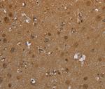 SCGB1D2 Antibody in Immunohistochemistry (Paraffin) (IHC (P))