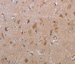MAGEF1 Polyclonal Antibody