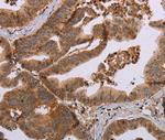 MFAP5 Polyclonal Antibody
