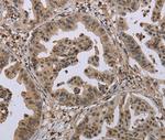 MCC Polyclonal Antibody