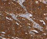 MCHR1 Polyclonal Antibody