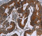 MDFIC Antibody in Immunohistochemistry (Paraffin) (IHC (P))
