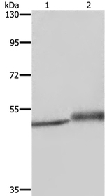 Mig-6 Antibody in Western Blot (WB)
