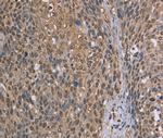 CAB39 Polyclonal Antibody