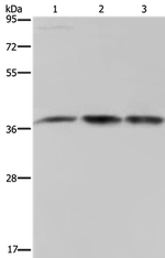 CAB39 Antibody in Western Blot (WB)