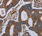 MT-ND6 Antibody in Immunohistochemistry (Paraffin) (IHC (P))