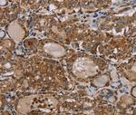 MT-ND6 Antibody in Immunohistochemistry (Paraffin) (IHC (P))