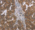 NDUFAF4 Polyclonal Antibody
