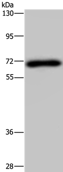 NMT1 Antibody in Western Blot (WB)