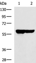 SLC22A12 Antibody in Western Blot (WB)