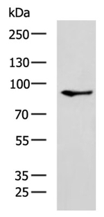 PARP8 Antibody in Western Blot (WB)