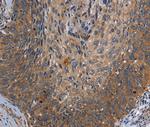 PARP10 Polyclonal Antibody