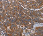 PARP10 Antibody in Immunohistochemistry (Paraffin) (IHC (P))