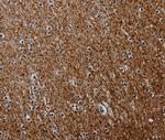 PCDHAC1 Polyclonal Antibody