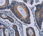 PCDHAC2 Polyclonal Antibody