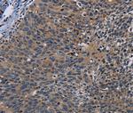 PCDHB15 Polyclonal Antibody