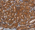 PDE5 Polyclonal Antibody