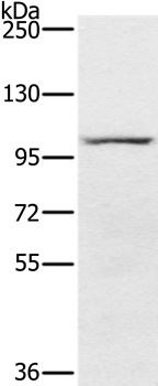 PDE5 Antibody in Western Blot (WB)