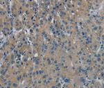 PHKG1 Polyclonal Antibody