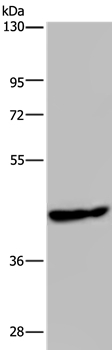 PHKG1 Antibody in Western Blot (WB)