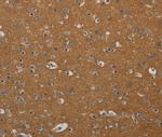 PIK3CD Antibody in Immunohistochemistry (Paraffin) (IHC (P))