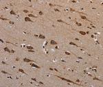 PLXNB1 Antibody in Immunohistochemistry (Paraffin) (IHC (P))