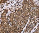 PLXNB1 Polyclonal Antibody