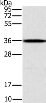 CENPV Antibody in Western Blot (WB)