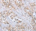PTPN4 Antibody in Immunohistochemistry (Paraffin) (IHC (P))