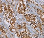 PUS10 Polyclonal Antibody