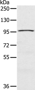 CIZ1 Polyclonal Antibody