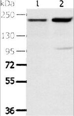 KDM5A Antibody in Western Blot (WB)