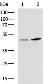Kir4.2 (KCNJ15) Antibody in Western Blot (WB)