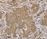 RNF148 Polyclonal Antibody
