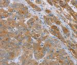 SAMD4A Polyclonal Antibody