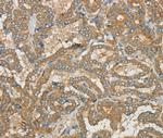 CWC27 Polyclonal Antibody