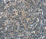 SEPN1 Antibody in Immunohistochemistry (Paraffin) (IHC (P))