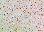 SEMA7A Polyclonal Antibody