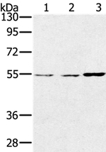 SESN2 Antibody in Western Blot (WB)