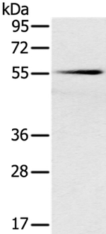 SLC16A10 Polyclonal Antibody