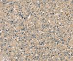SMAGP Antibody in Immunohistochemistry (Paraffin) (IHC (P))