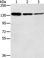 SMC2 Polyclonal Antibody