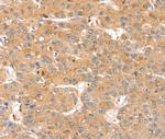 SMOC2 Polyclonal Antibody