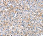 SNX25 Polyclonal Antibody