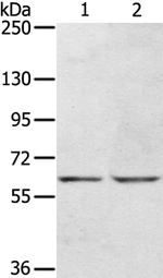 KCNH6 Antibody in Western Blot (WB)
