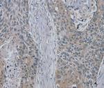 RASA4 Polyclonal Antibody